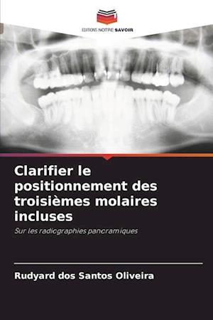 Clarifier le positionnement des troisièmes molaires incluses