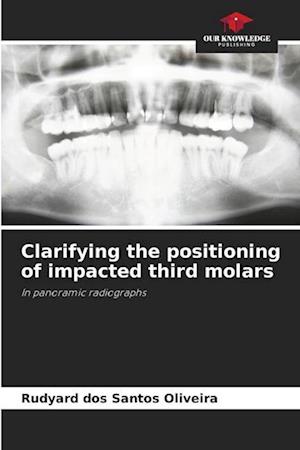 Clarifying the positioning of impacted third molars