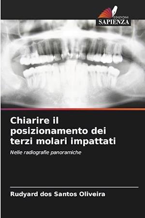 Chiarire il posizionamento dei terzi molari impattati