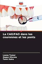 La CAO/FAO dans les couronnes et les ponts