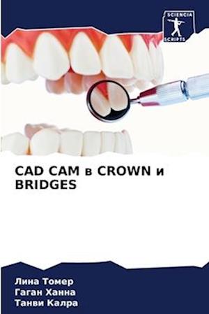 CAD CAM w CROWN i BRIDGES