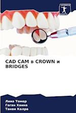 CAD CAM w CROWN i BRIDGES