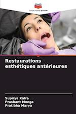 Restaurations esthétiques antérieures