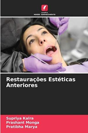 Restaurações Estéticas Anteriores