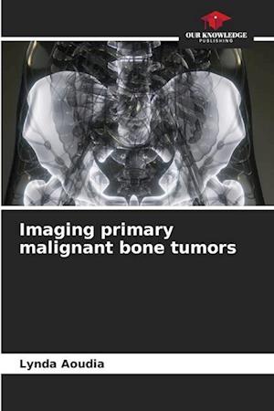 Imaging primary malignant bone tumors