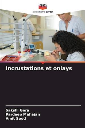 Incrustations et onlays