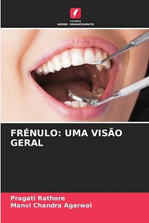 FRÉNULO: UMA VISÃO GERAL