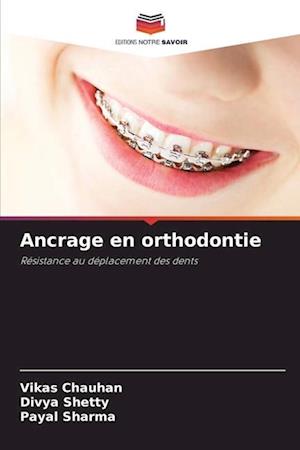 Ancrage en orthodontie