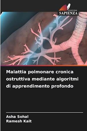 Malattia polmonare cronica ostruttiva mediante algoritmi di apprendimento profondo