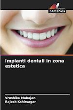 Impianti dentali in zona estetica