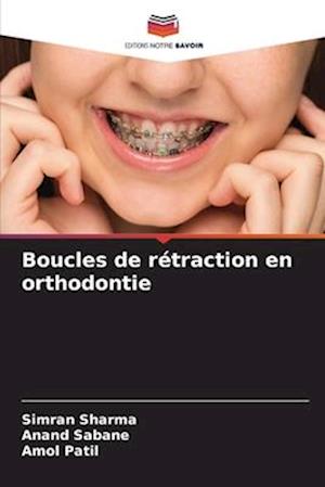 Boucles de rétraction en orthodontie