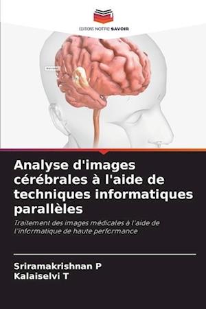 Analyse d'images cérébrales à l'aide de techniques informatiques parallèles