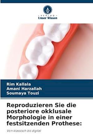 Reproduzieren Sie die posteriore okklusale Morphologie in einer festsitzenden Prothese: