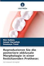 Reproduzieren Sie die posteriore okklusale Morphologie in einer festsitzenden Prothese: