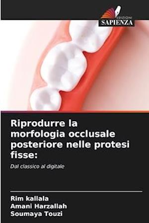 Riprodurre la morfologia occlusale posteriore nelle protesi fisse: