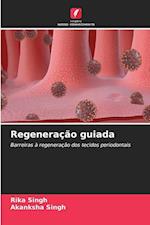 Regeneração guiada