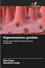 Rigenerazione guidata