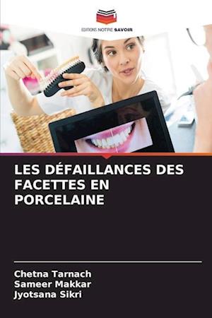 LES DÉFAILLANCES DES FACETTES EN PORCELAINE