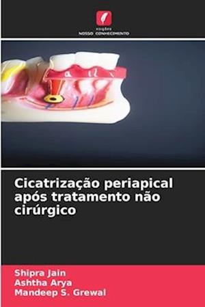 Cicatrização periapical após tratamento não cirúrgico