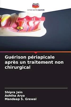 Guérison périapicale après un traitement non chirurgical