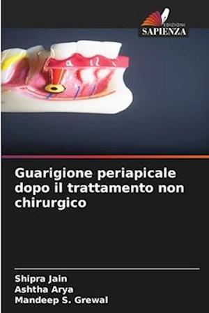 Guarigione periapicale dopo il trattamento non chirurgico