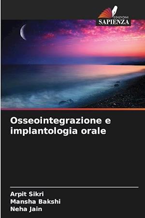 Osseointegrazione e implantologia orale