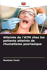 Atteinte de l'ATM chez les patients atteints de rhumatisme psoriasique