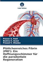 Plättchenreiches Fibrin (PRF): Ein Hoffnungsschimmer für die parodontale Regeneration