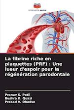 La fibrine riche en plaquettes (PRF) : Une lueur d'espoir pour la régénération parodontale