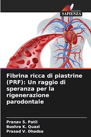 Fibrina ricca di piastrine (PRF): Un raggio di speranza per la rigenerazione parodontale