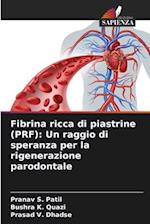 Fibrina ricca di piastrine (PRF): Un raggio di speranza per la rigenerazione parodontale