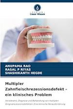 Multipler Zahnfleischrezessionsdefekt ¿ ein klinisches Problem