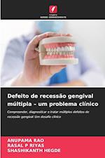 Defeito de recessão gengival múltipla ¿ um problema clínico