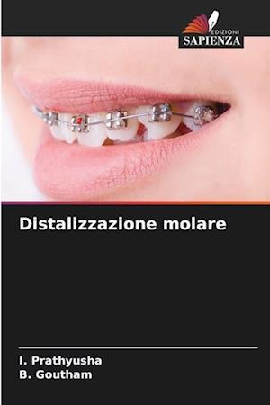 Distalizzazione molare