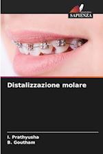 Distalizzazione molare