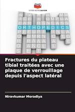 Fractures du plateau tibial traitées avec une plaque de verrouillage depuis l'aspect latéral