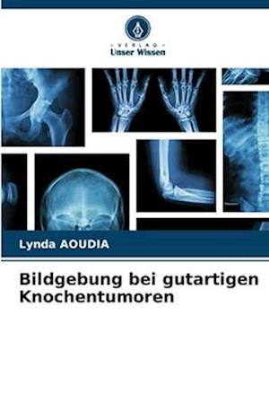 Bildgebung bei gutartigen Knochentumoren