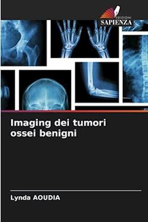 Imaging dei tumori ossei benigni