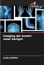 Imaging dei tumori ossei benigni