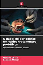 O papel do periodonto em vários tratamentos protéticos