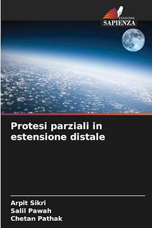 Protesi parziali in estensione distale