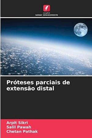 Próteses parciais de extensão distal