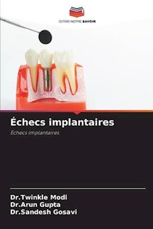 Échecs implantaires