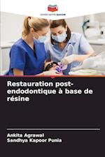 Restauration post-endodontique à base de résine