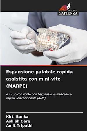 Espansione palatale rapida assistita con mini-vite (MARPE)