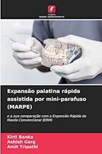 Expansão palatina rápida assistida por mini-parafuso (MARPE)