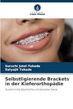 Selbstligierende Brackets in der Kieferorthopädie