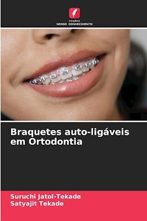 Braquetes auto-ligáveis em Ortodontia