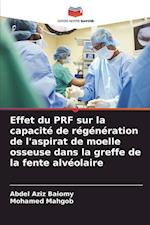 Effet du PRF sur la capacité de régénération de l'aspirat de moelle osseuse dans la greffe de la fente alvéolaire