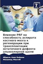 Vliqnie PRF na sposobnost' aspirata kostnogo mozga k regeneracii pri transplantacii ostatochnogo defekta al'weolqrnoj scheli